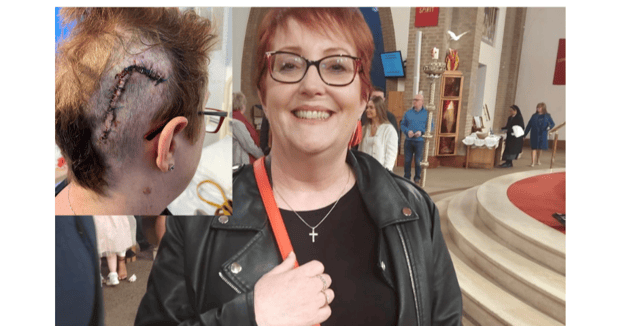 Shirley McEntee, a cancer survivor and ex sunbed user