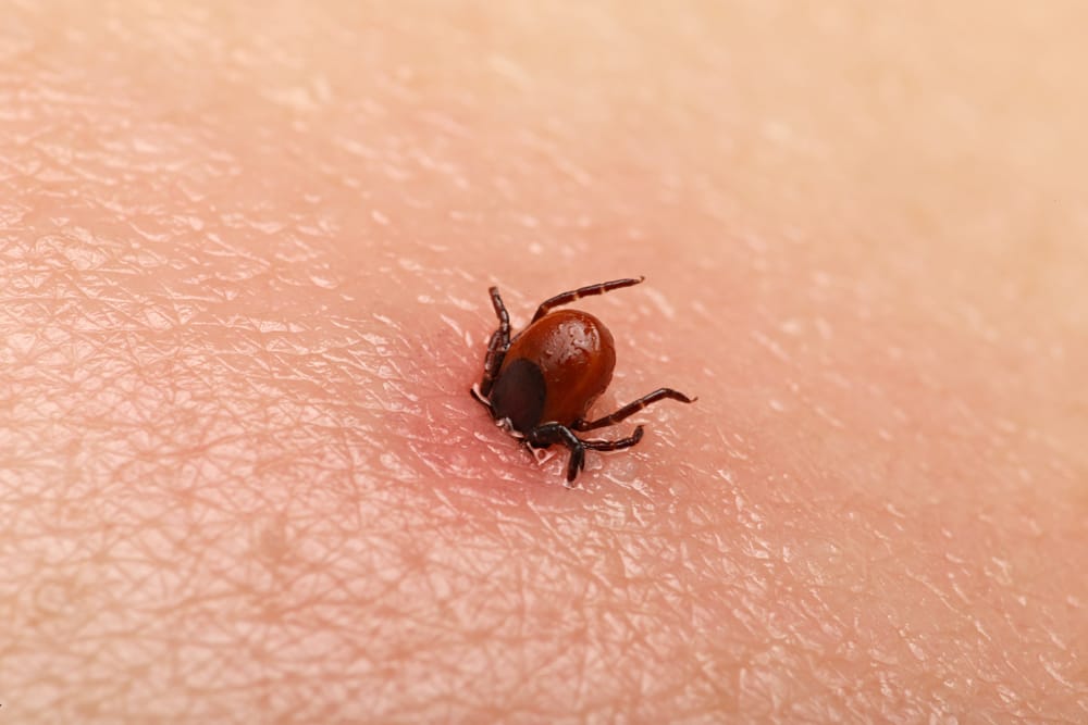 Lyme Disease sufferers in Kilkenny will take part in International Lyme Disease Awareness Day