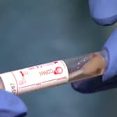 Coronavirus Covid-19 testing has reached 1,000