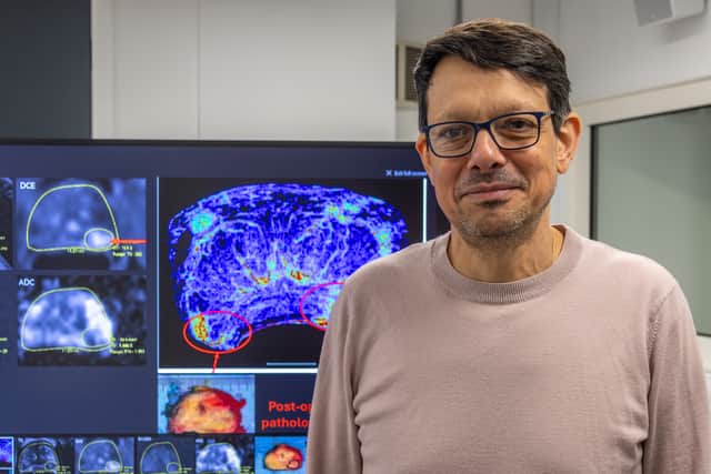 New prostate cancer imaging shows ‘extremely encouraging’ results in trials