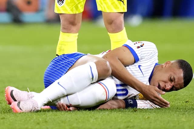 Les Bleus to wait for masked Mbappe
