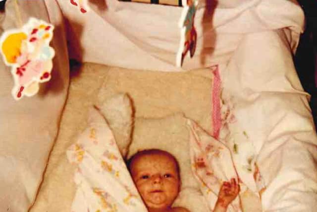 From the day she was born, June 26, 1984, she has fought a painful daily battle with the incurable condition, which has caused her fingers to gradually fuse together.