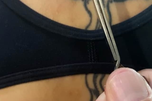 Out of desperation, she turned to bee venom therapy and was helped by her husband, Joshua Colburn, 43, to be stung by live bees several times a week for two and a half years.