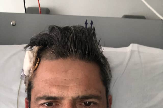 “Then I suddenly woke up and the surgeon who I called Fortinbras (from William Shakespeare’s Hamlet) because he was a straight talker said ‘We thought that we’d nearly lost you’.”