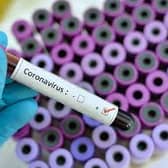 Part of new coronavirus test being made in Donegal