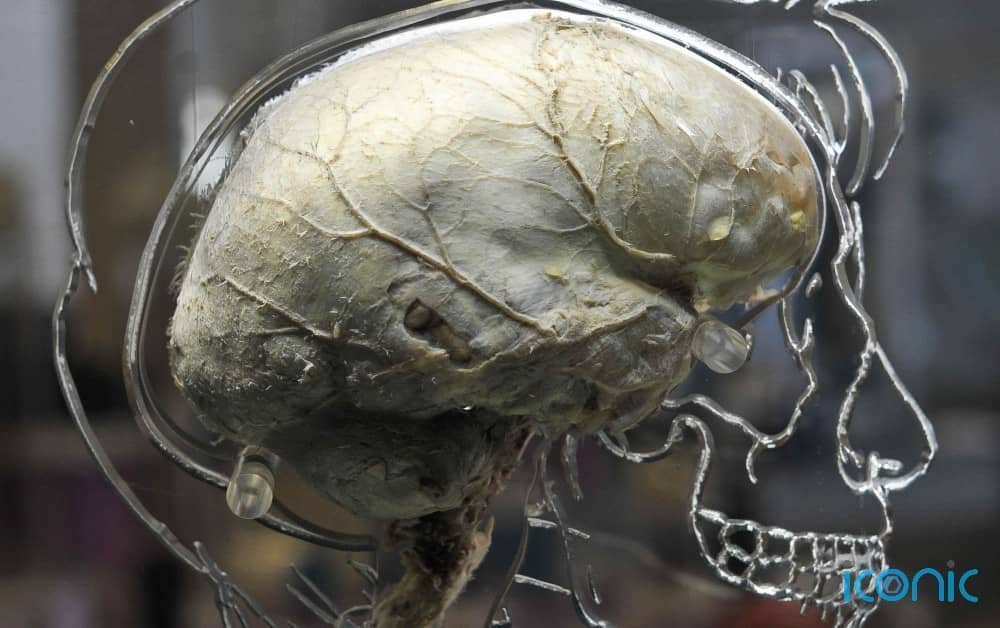 The study challenges previous assumptions that mental speed peaks at age 20
