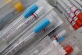 Limerick GPs are urging their patients to get the flu vaccine - particularly given the Covid-19 pandemic