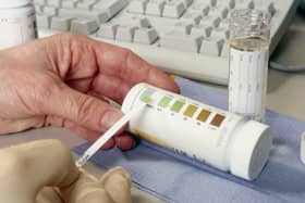 A doctor carries out a urine glucose test for a patient (Picture: Charles Milligan/Hulton Archive)