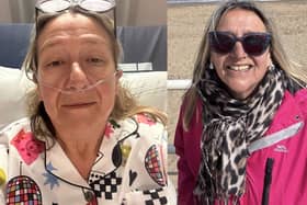 Ruth Lloyd-Williams in hospital (left picture) vs Ruth Lloyd-Williams wearing sunglasses (right picture)