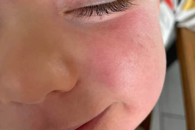 ‘A doctor told us not to be worried when our 3-year-old developed a ...
