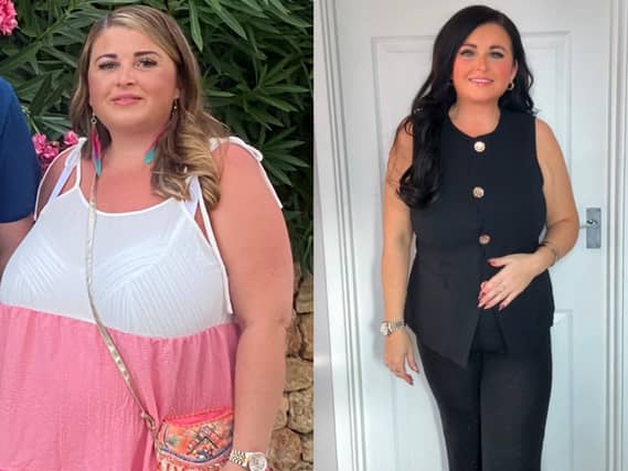 Amy before and after losing weight