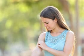 Young woman standing in a park itching her arm