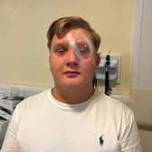 Mikey Maughan wearing an eye patch after Castlebar attack