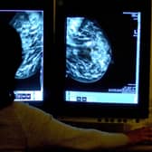 Person seen from behind looking at breast screening images