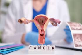 Anatomical model of uterus and ovaries above blocks that spell out cancer