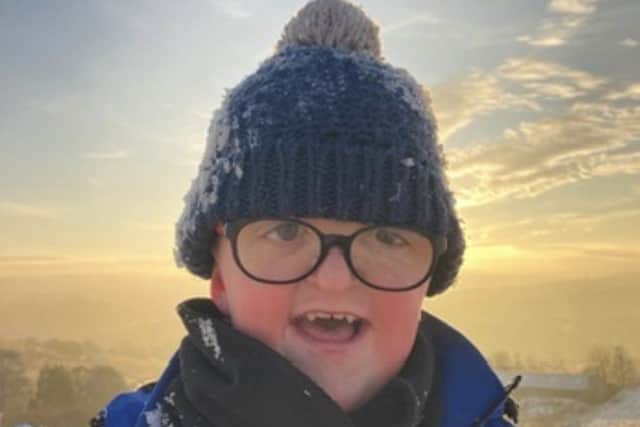 Lewis was born with the condition (Collect/PA Real Life)