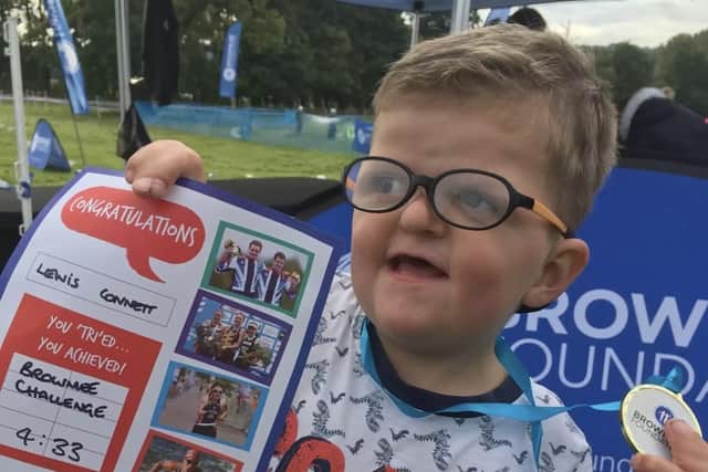 Alder Hey is one of a handful of hospitals in the UK which has the infrastructure, multidisciplinary expertise, and experience to treat and support people with Apert syndrome (Collect/PA Real Life)