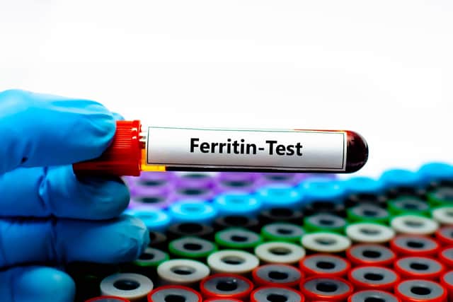 A standard iron profile test typically includes ferritin levels (Alamy/PA)