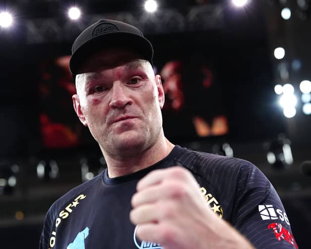 Tyson Fury raises a fist in triumph