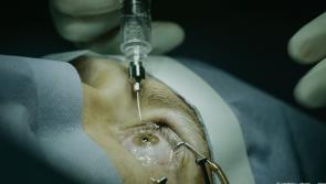 Eye patients forced to travel to Sligo for treatment