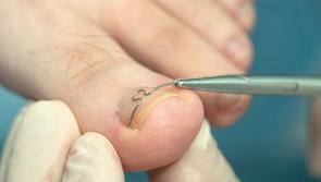 Removal of HSE Podiatry service is affecting health of elderly and ill people
