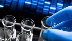 Derry has the highest rate of genetic haemochromatosis