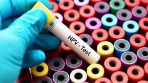 Roll-out of life-saving HPV screening welcomed