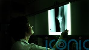 NHS medics call for osteoporosis drug to be recommended in England and Wales