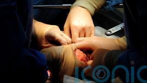 Female patients more likely to die if surgeon is male, study finds
