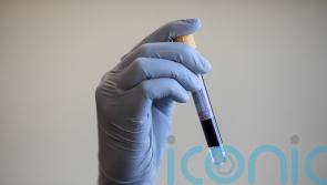 Health board bids to trace patient after HIV detected in blood sample