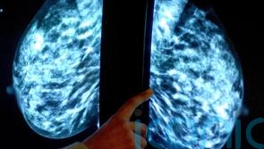 Cancers services in Northern Ireland facing ‘massive perfect storm’, MLAs warned