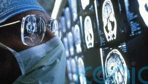 Most Scots not getting enough sleep as organisation urges focus on brain health