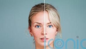 Anti-inflammatory skincare is the latest soothing trend to help ease redness