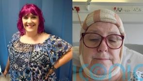 School finance officer fears she looks like “a gargoyle” or “Frankenstein’s monster” as virulent skin cancer leaves bald “craters” on her scalp