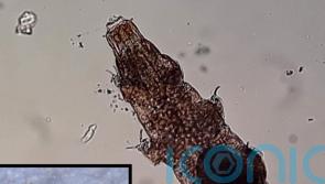 Tardigrades ‘can hitch rides on snails but the slime hampers survival’