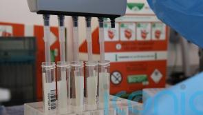 Number of people to die in Scotland after positive Covid test passes 12,000