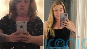 Mum who “looks like a bear” at 20st 5lb feels sexy after losing 9st 2lb and having £6k “mummy makeover” and implants for “loopy” breasts