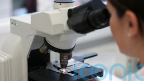 Four more children found to have hepatitis in Scotland