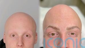 Student who loses his head and body hair at 15 saying GCSE stress caused alopecia has eyebrow tattoos inspired by mum’s beauty treatments
