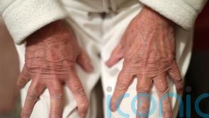 Risk factors for dementia may vary with age, study suggests
