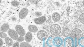 Israel becomes latest country to report monkeypox case
