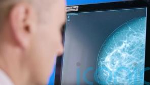 Breast screening review makes 17 recommendations to improve services