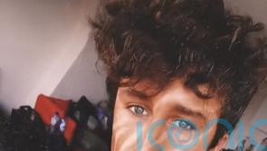 VIDEO: Struggling musician covers himself in an incredible zebra tan – attracting 20 million views on TikTok and attention from hundreds of women