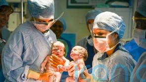 Pre-birth steroids could reduce risk of death in premature twins, study suggests