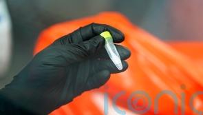 Spain records first death from monkeypox