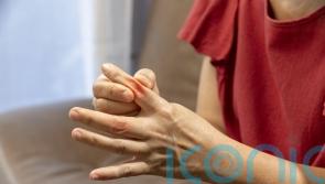 Gout flare-ups linked to risk of heart attack and stroke – study