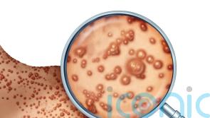US declares public health emergency over monkeypox outbreak