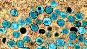 Vaccination advice for groups most at risk of monkeypox to be issued soon