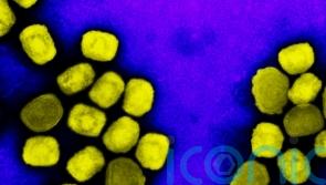 Monkeypox cases increase by two in Scotland, figures show