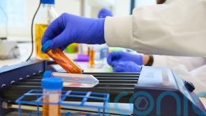 ‘Months of anxiety’ – Ex-councillor reveals toll of prostate cancer tests